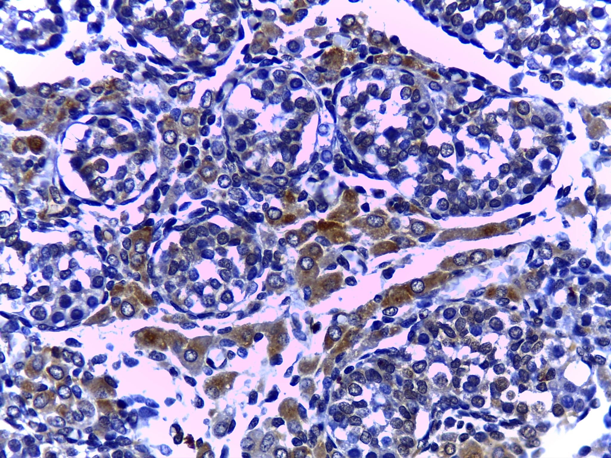 IGF-I R/IGF1R Antibody (3G5C1) NB110-87052