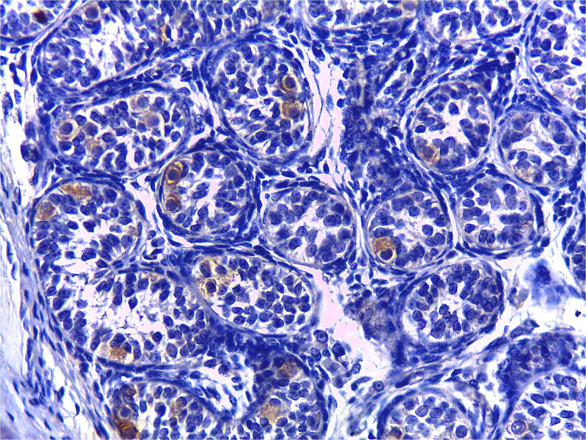 IGF-I R/IGF1R Antibody (3G5C1) NB110-87052