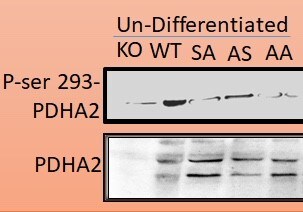 Pyruvate Dehydrogenase E1-alpha subunit [p Ser293] Antibody - BSA Free NB110-93479