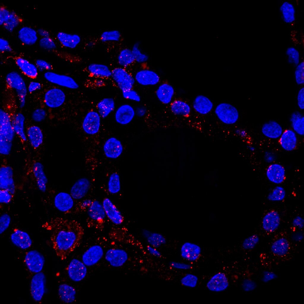 BDNF Antibody (35928.11) - Azide and BSA Free NB120-10505