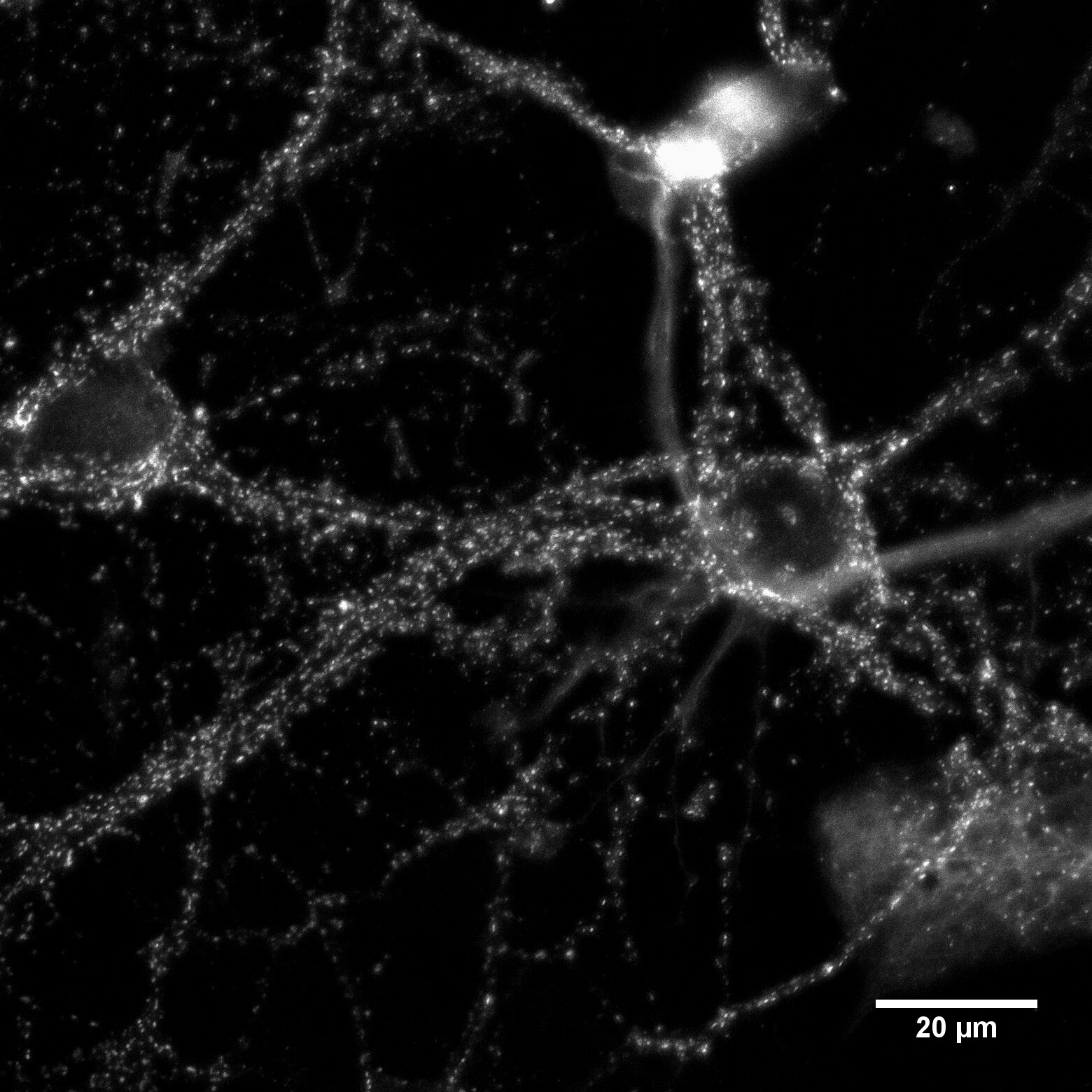 Bassoon Antibody (SAP7F407) - BSA Free NB120-13249