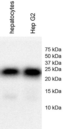 Rab5a Antibody - BSA Free NB120-13253