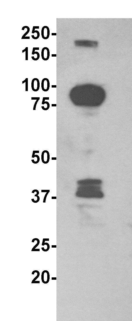 DNMT3A Antibody (64B1446) - BSA Free NB120-13888
