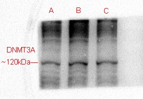 DNMT3A Antibody (64B1446) - BSA Free NB120-13888