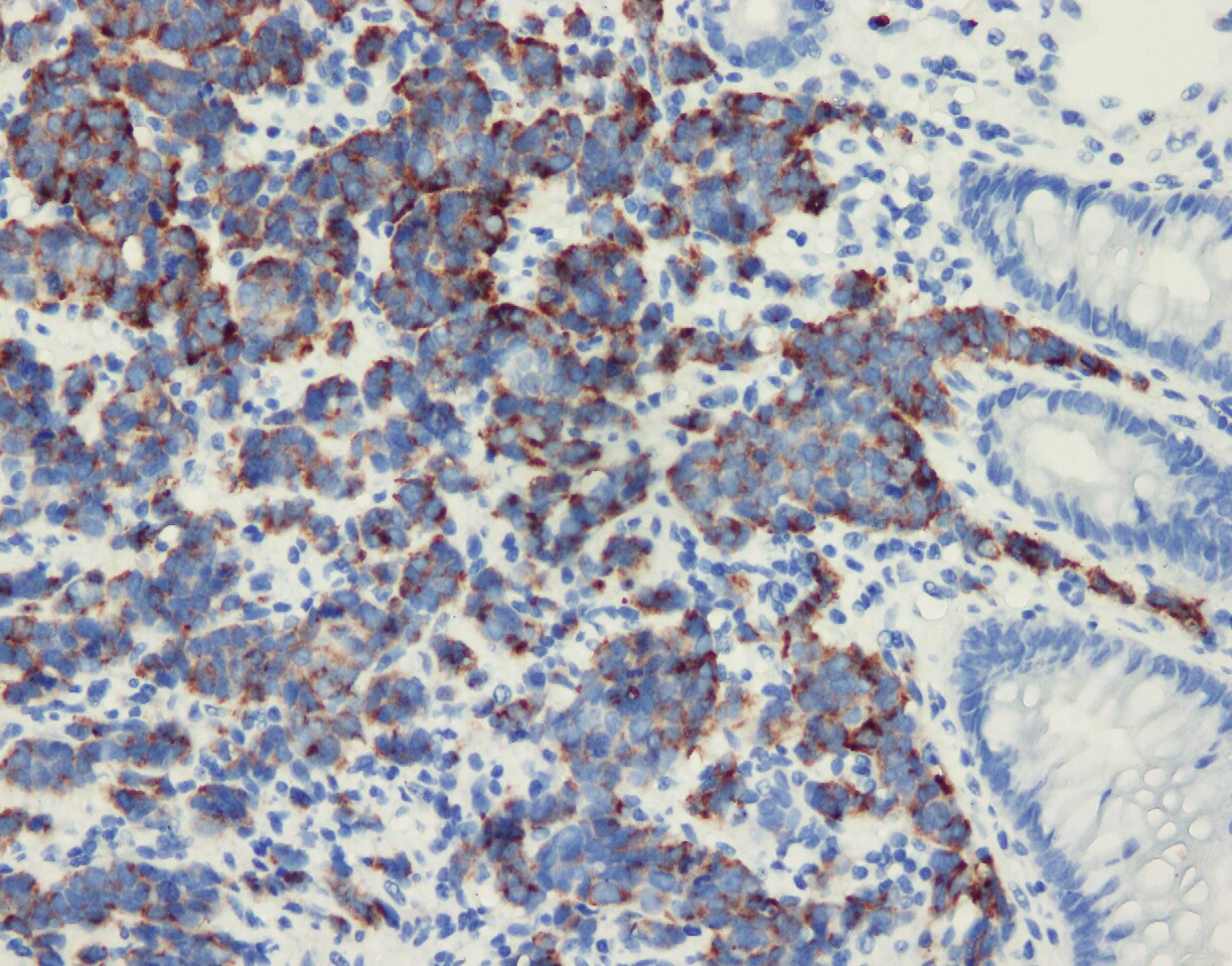 Procalcitonin Antibody (44D9) - BSA Free NB120-14817