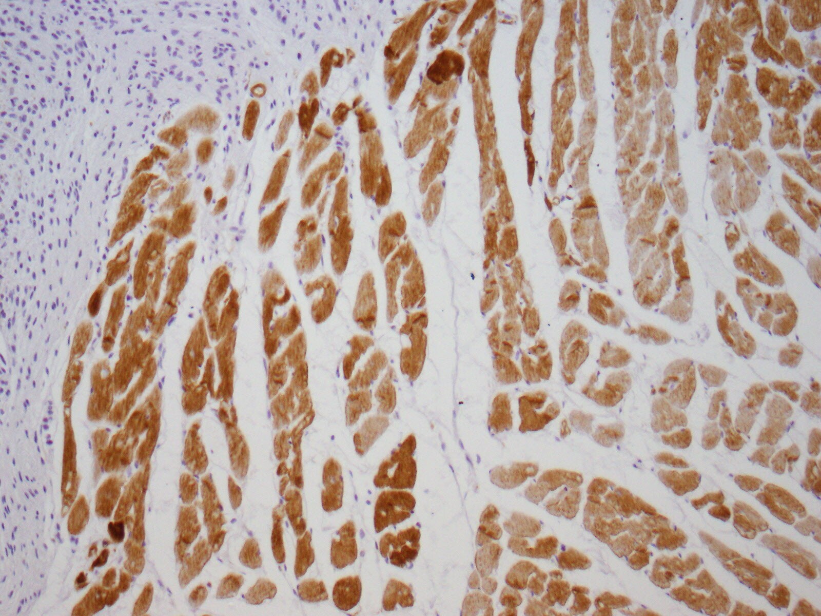 Desmin Antibody (D33) NB120-17156
