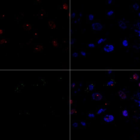 Calcium-sensing R/CaSR Antibody (5C10, ADD) - BSA Free NB120-19347