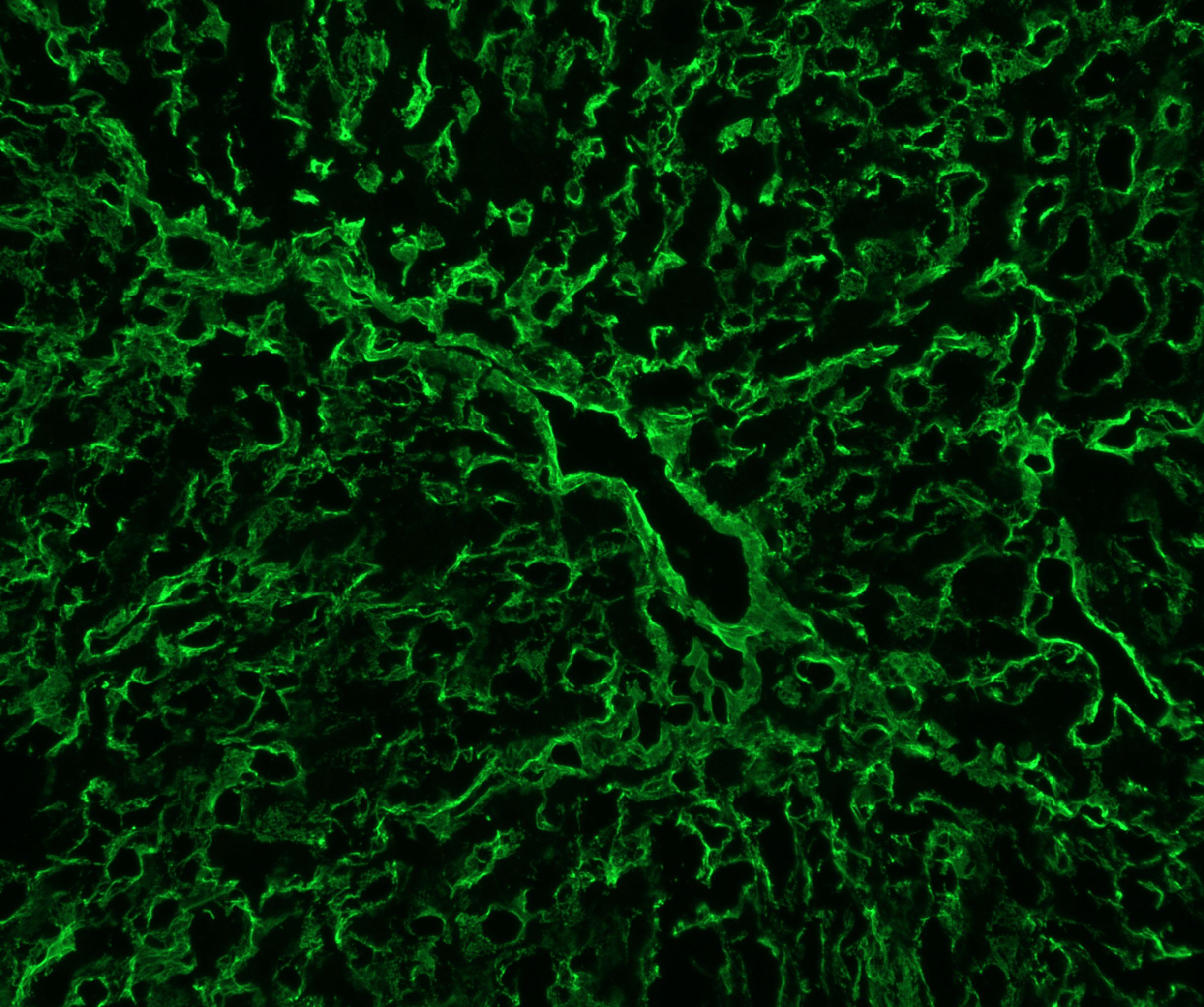 Collagen IV Antibody - BSA Free NB120-6586