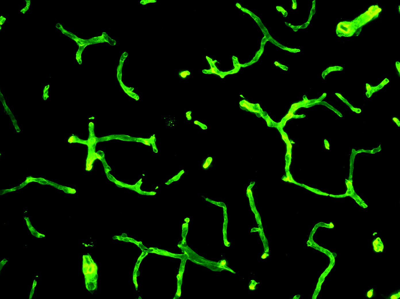 Collagen IV Antibody - BSA Free NB120-6586