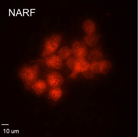 Goat anti-Rabbit IgG (H+L) Secondary Antibody [Texas Red] (Pre-adsorbed) NB120-7088