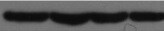 Pappalysin-1/PAPP-A Antibody (10E1cc) - BSA Free NB120-8346