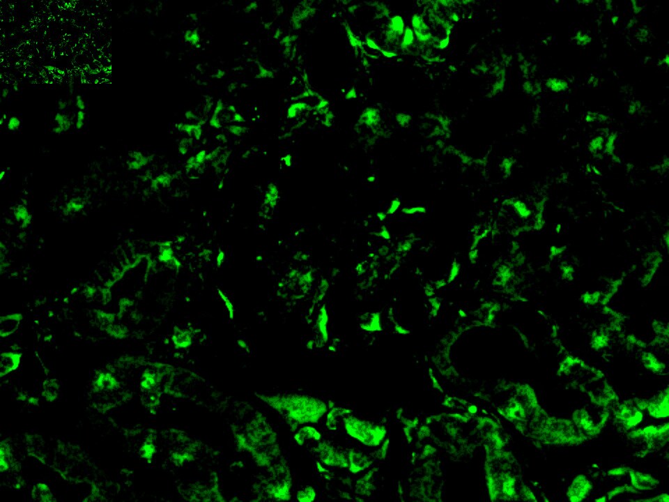p19ARF/CDKN2A Antibody - BSA Free NB200-106