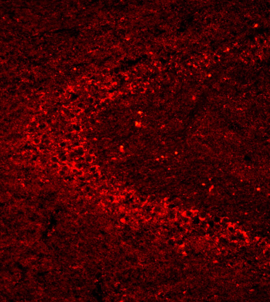 p14ARF/CDKN2A Antibody [Biotin] NB200-111B