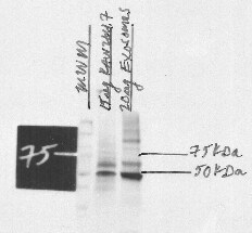 TSG101 Antibody (4A10) NB200-112