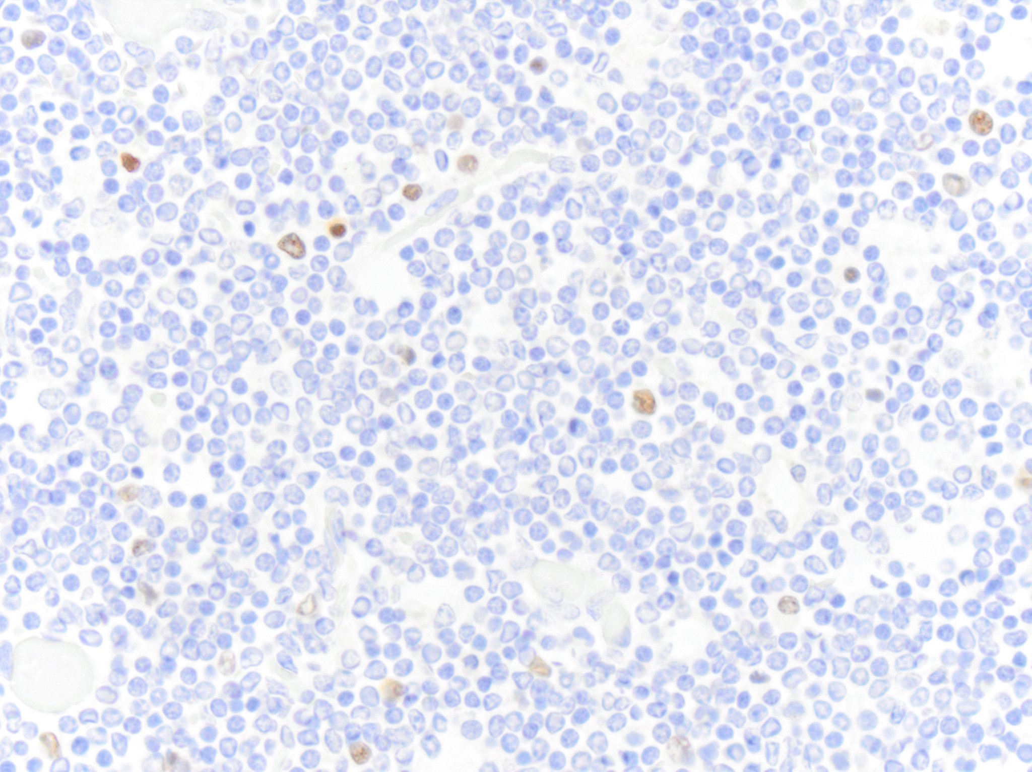 MUM1 Antibody (MUM1p) NB200-356