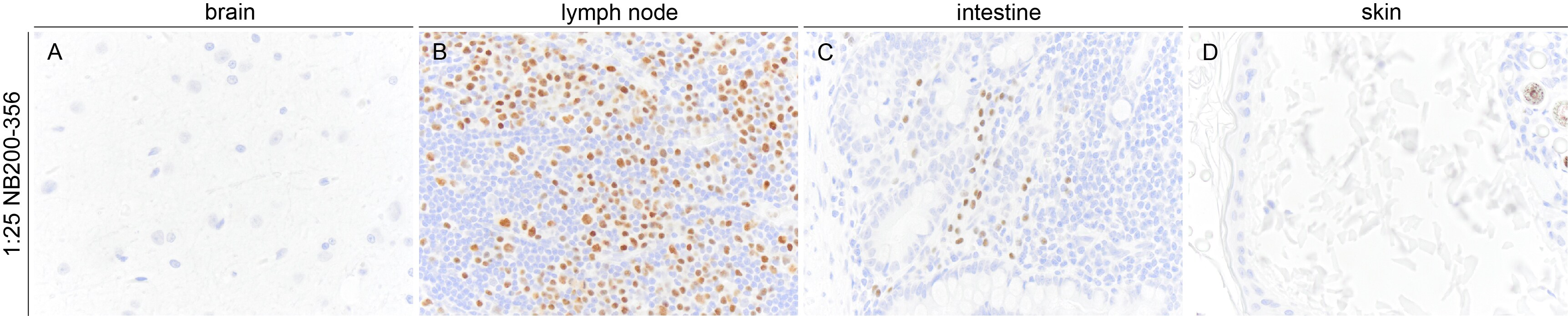 MUM1 Antibody (MUM1p) NB200-356