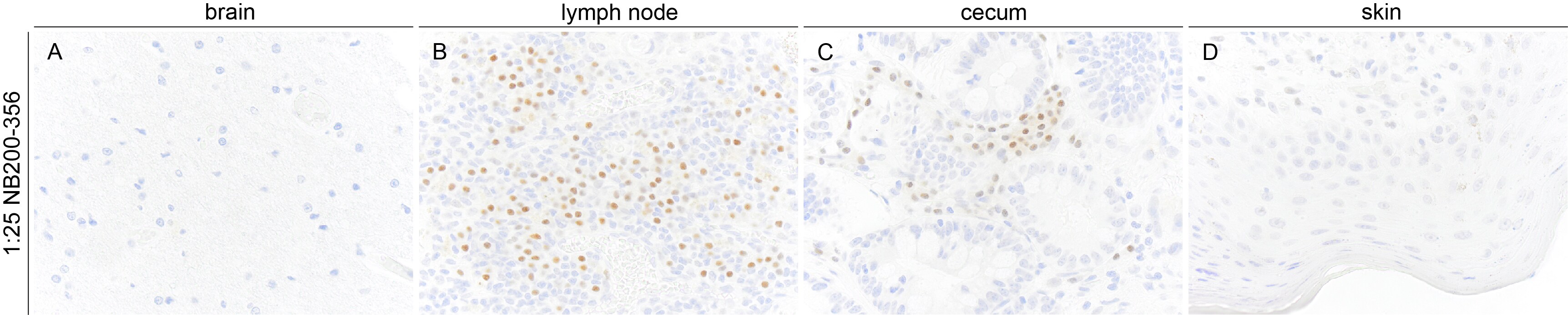 MUM1 Antibody (MUM1p) NB200-356