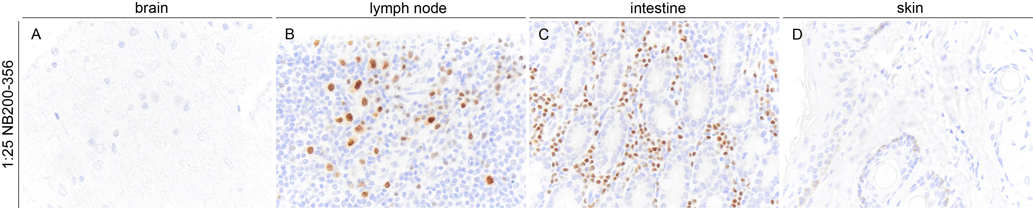 MUM1 Antibody (MUM1p) NB200-356
