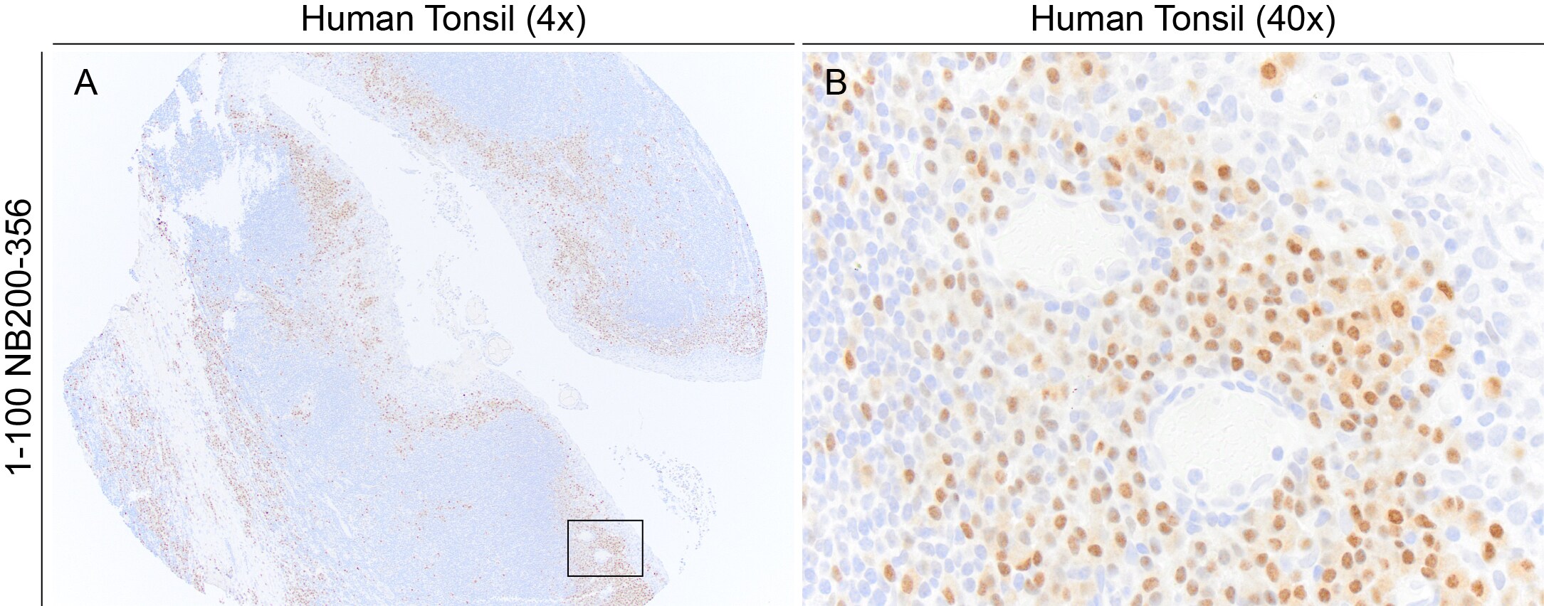 MUM1 Antibody (MUM1p) NB200-356