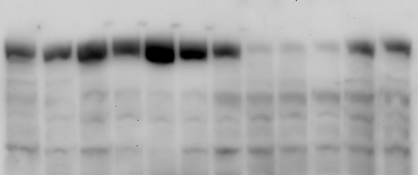 Apolipoprotein B/ApoB Antibody NB200-527