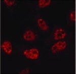 Dnmt2 Antibody (102B1259.2) - BSA Free NB200-587