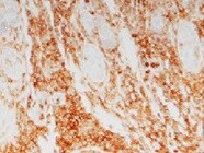 Integrin beta 2/CD18 Antibody (YFC118.3) - BSA Free NB200-610