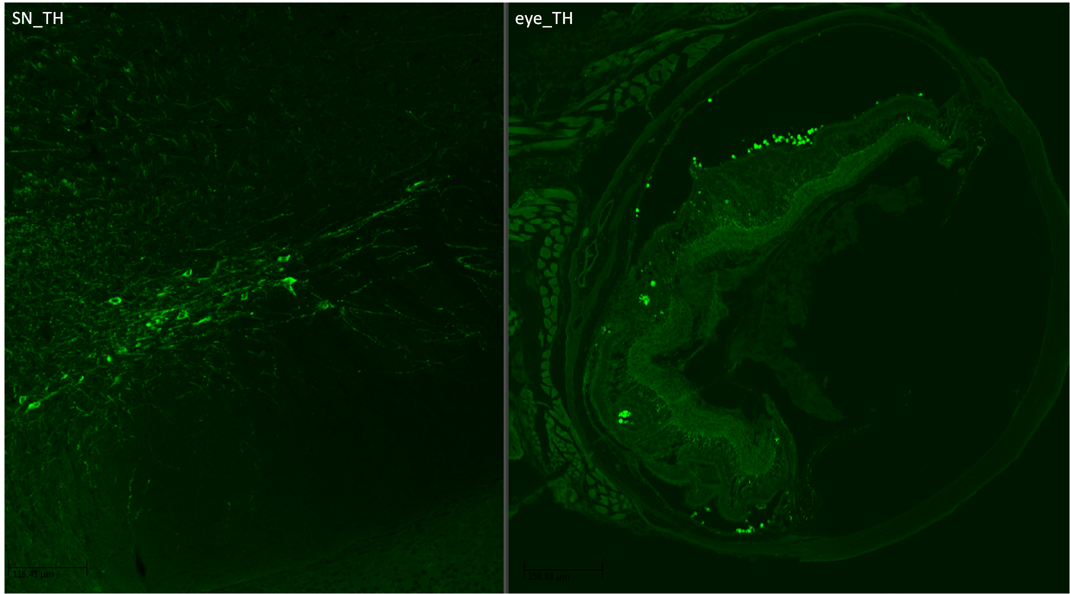 Tyrosine Hydroxylase Antibody - Azide Free NB300-109