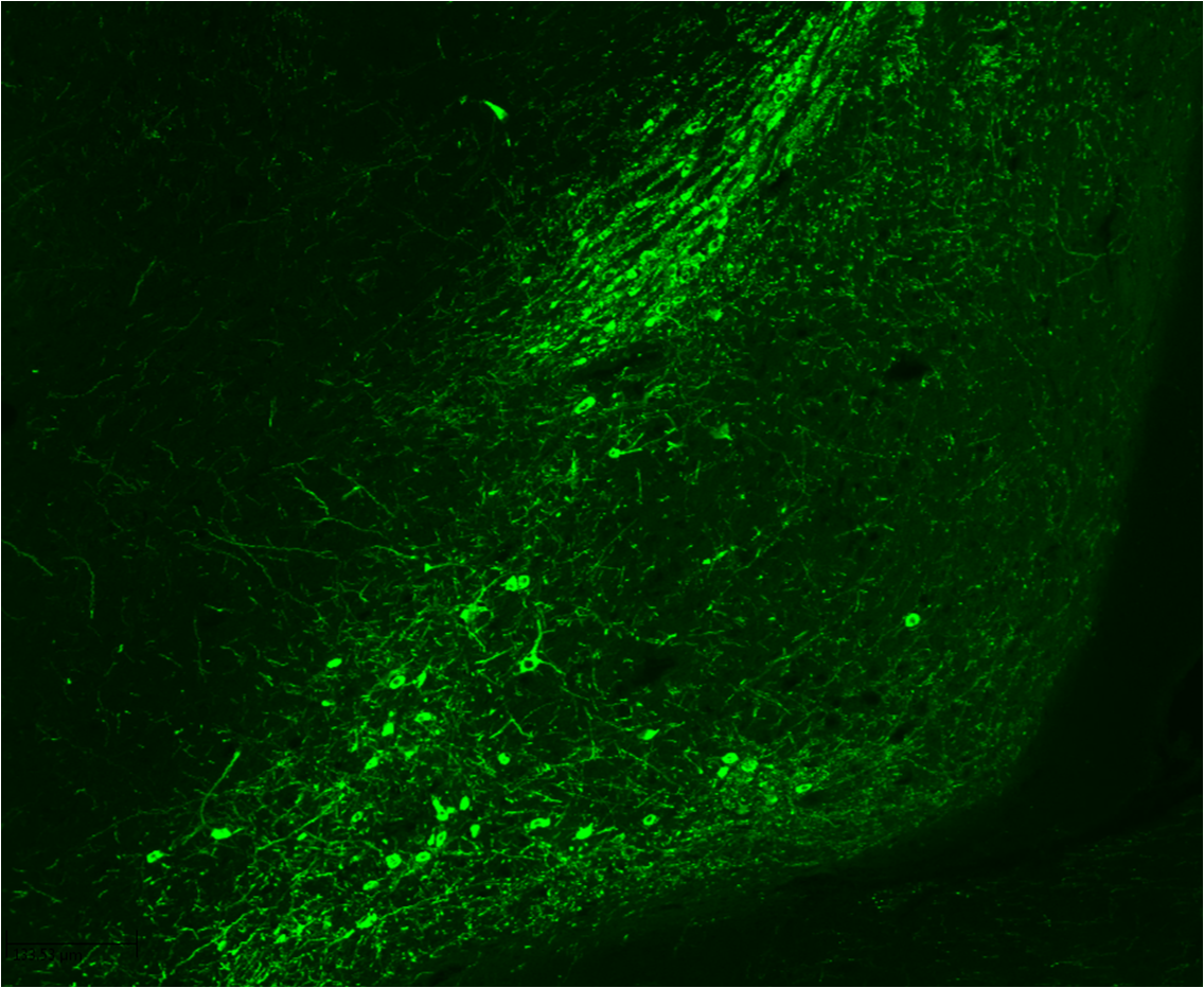 Tyrosine Hydroxylase Antibody - Azide Free NB300-110