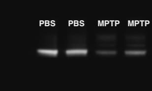 Tyrosine Hydroxylase Antibody - Azide Free NB300-110