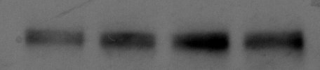 NMDAR1 Antibody (R1JHL) NB300-118