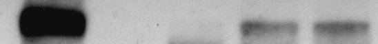NMDAR1 Antibody (R1JHL) NB300-118