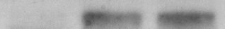 NMDAR1 Antibody (R1JHL) NB300-118