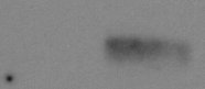 NMDAR1 Antibody (R1JHL) NB300-118