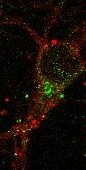 NMDAR1 Antibody (R1JHL) NB300-118