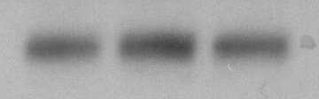 NMDAR1 Antibody (R1JHL) NB300-118