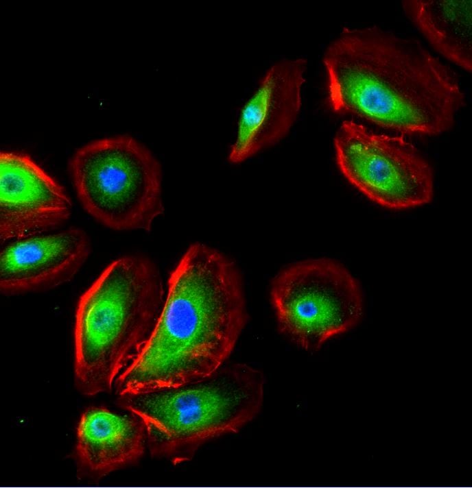 NK1R Antibody - BSA Free NB300-119