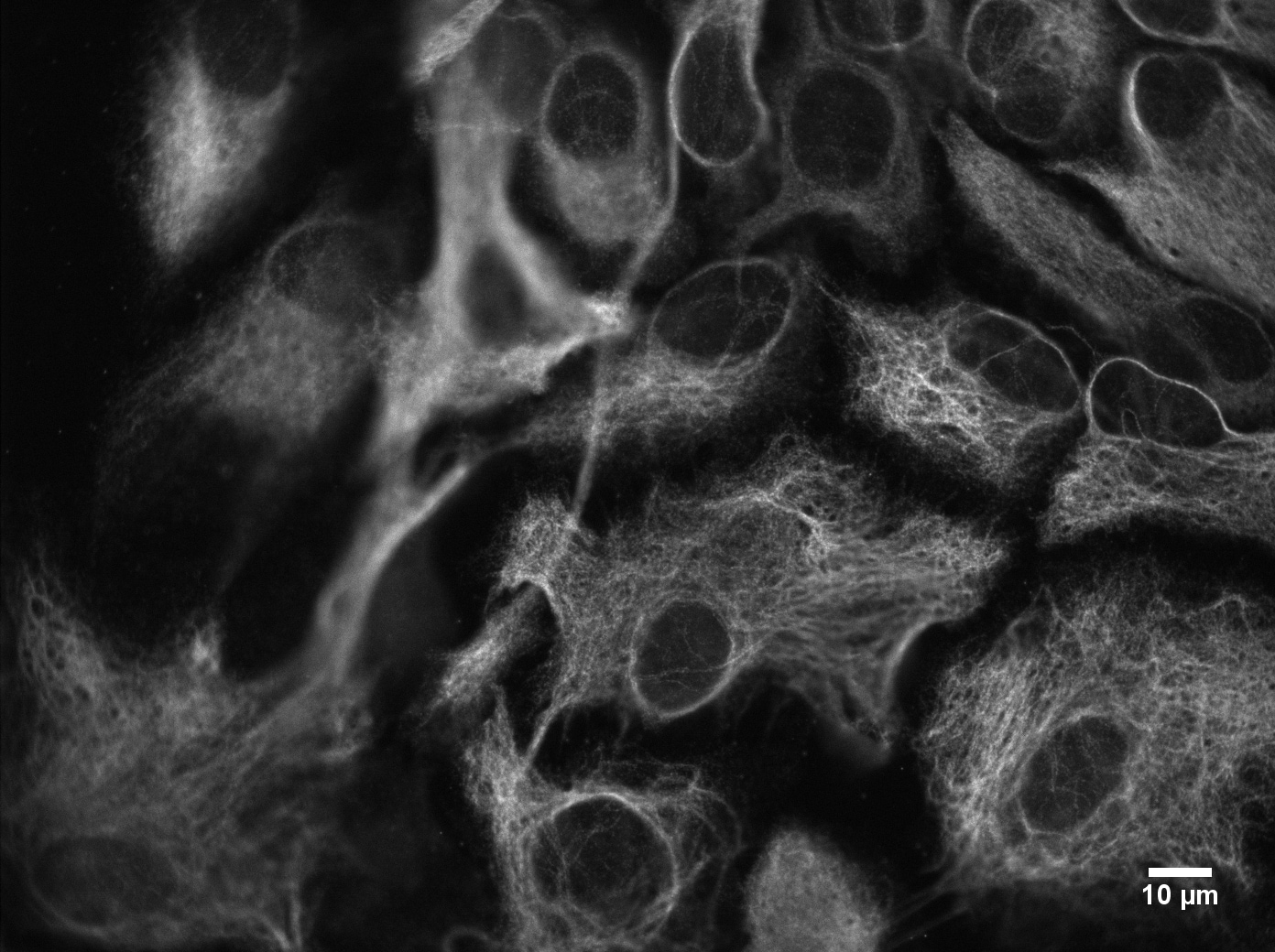 GFAP Antibody NB300-141