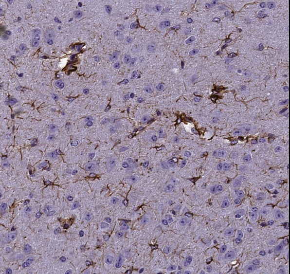 GFAP Antibody NB300-141