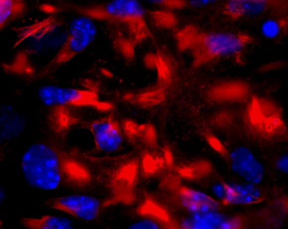 GFAP Antibody NB300-141