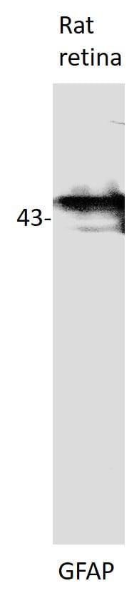 GFAP Antibody NB300-141