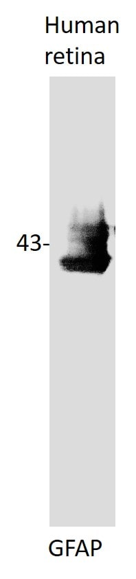GFAP Antibody NB300-141
