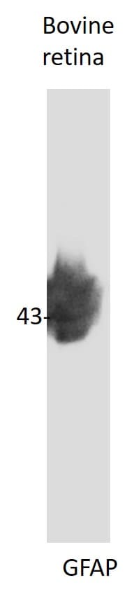 GFAP Antibody NB300-141
