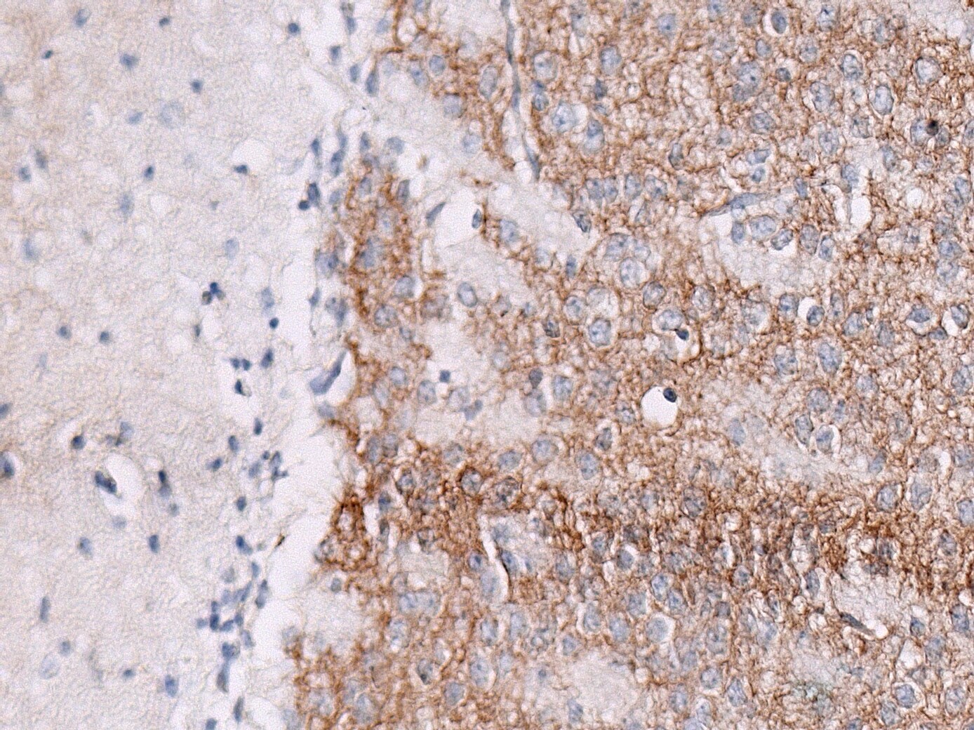 GABA-A R beta 3 Antibody - Azide Free NB300-199