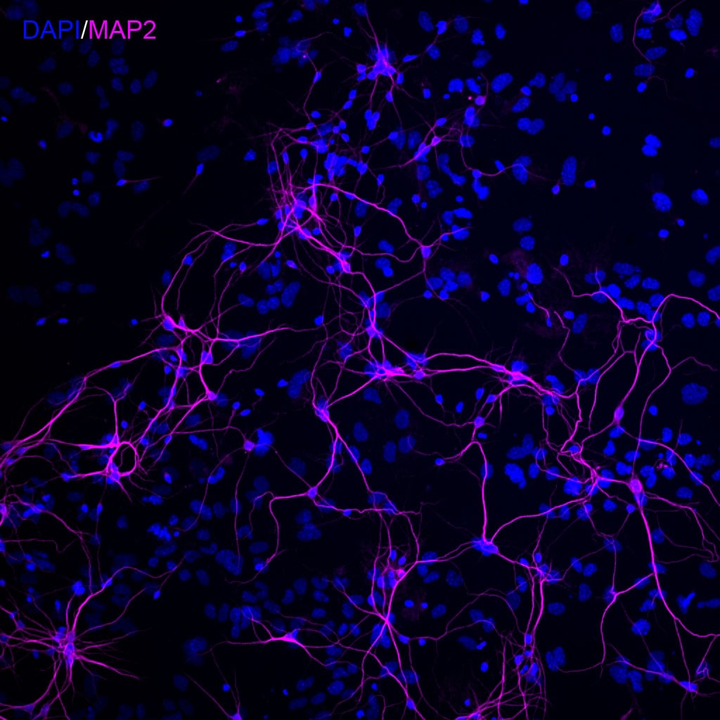 MAP2 Antibody - BSA Free NB300-213