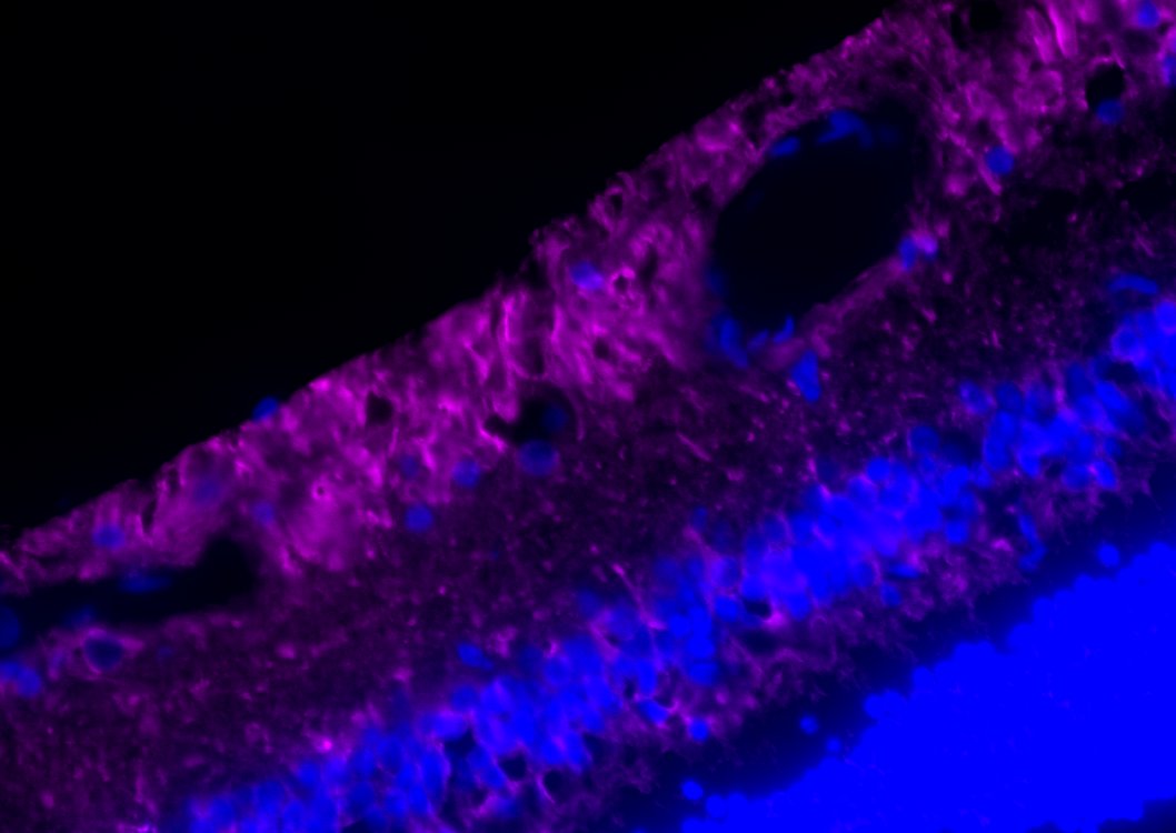 MAP2 Antibody - BSA Free NB300-213