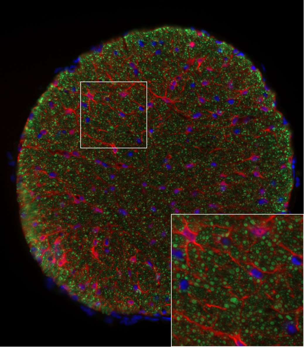 NF-H Antibody - BSA Free NB300-217