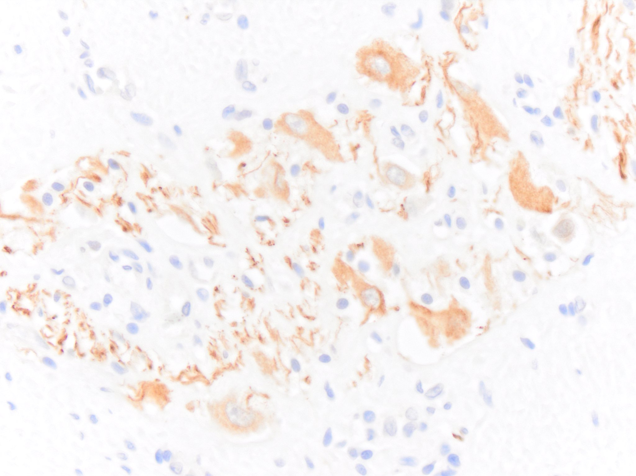 NF-H Antibody - BSA Free NB300-217