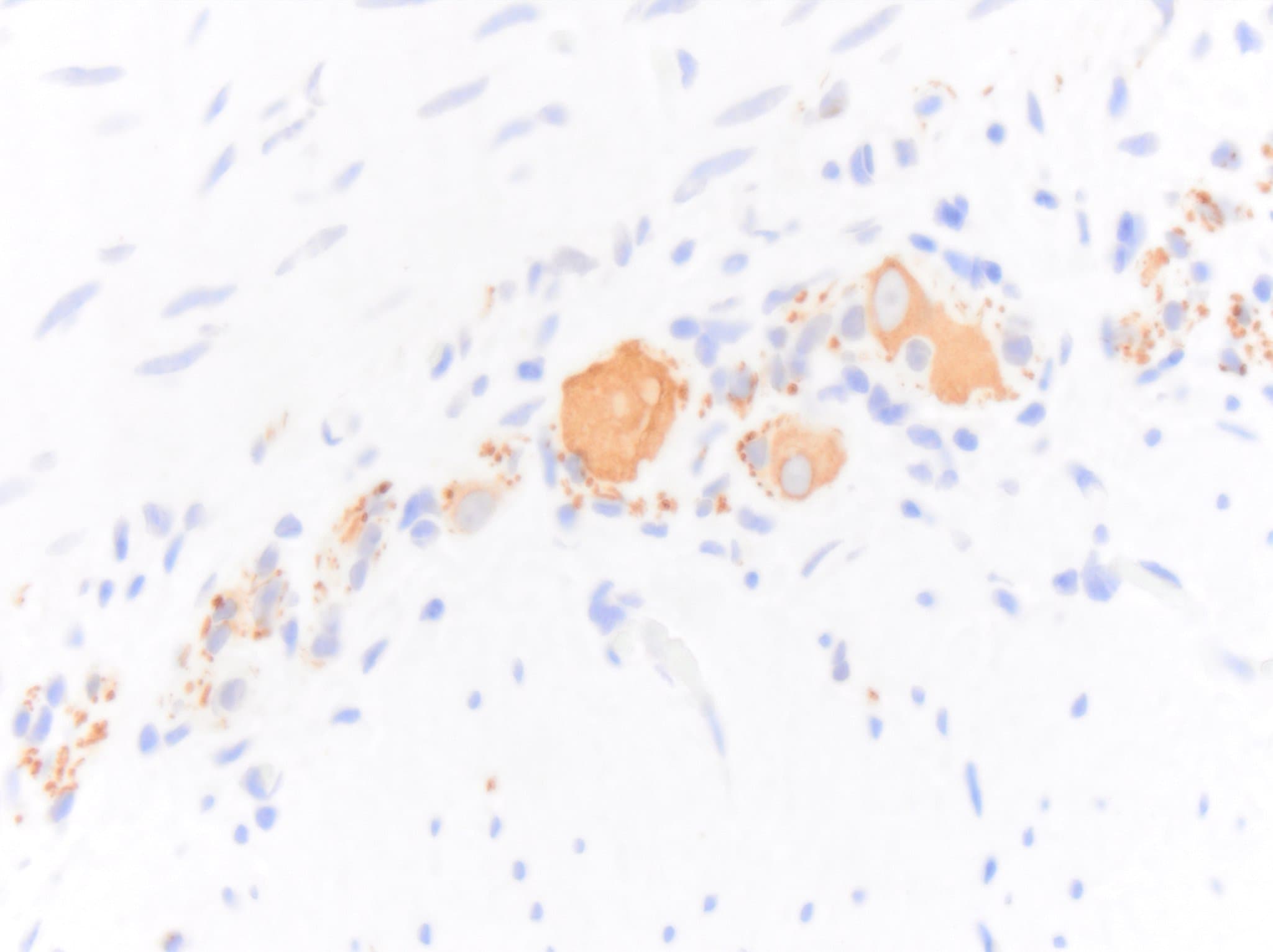 NF-H Antibody - BSA Free NB300-217