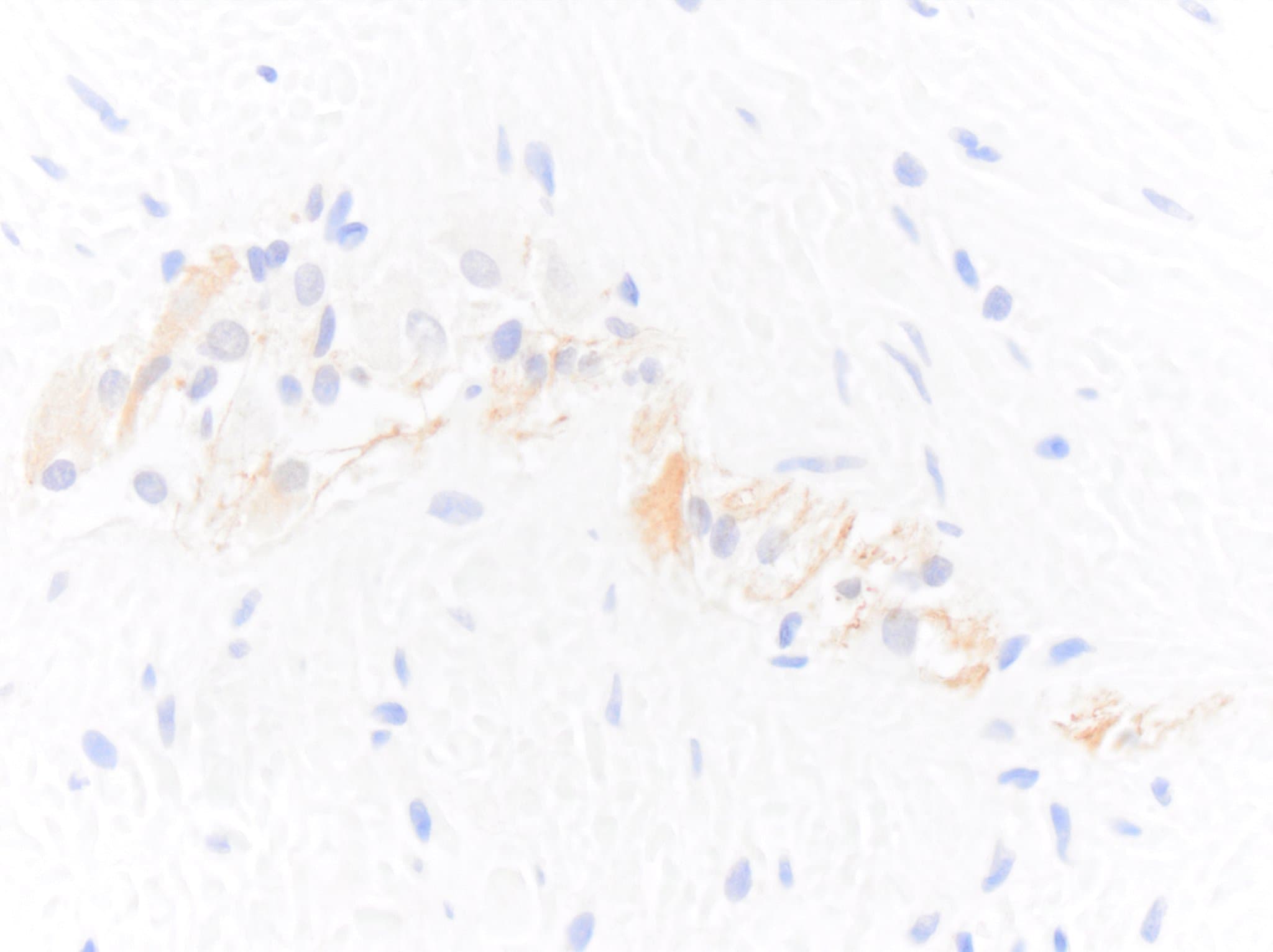 NF-H Antibody - BSA Free NB300-217
