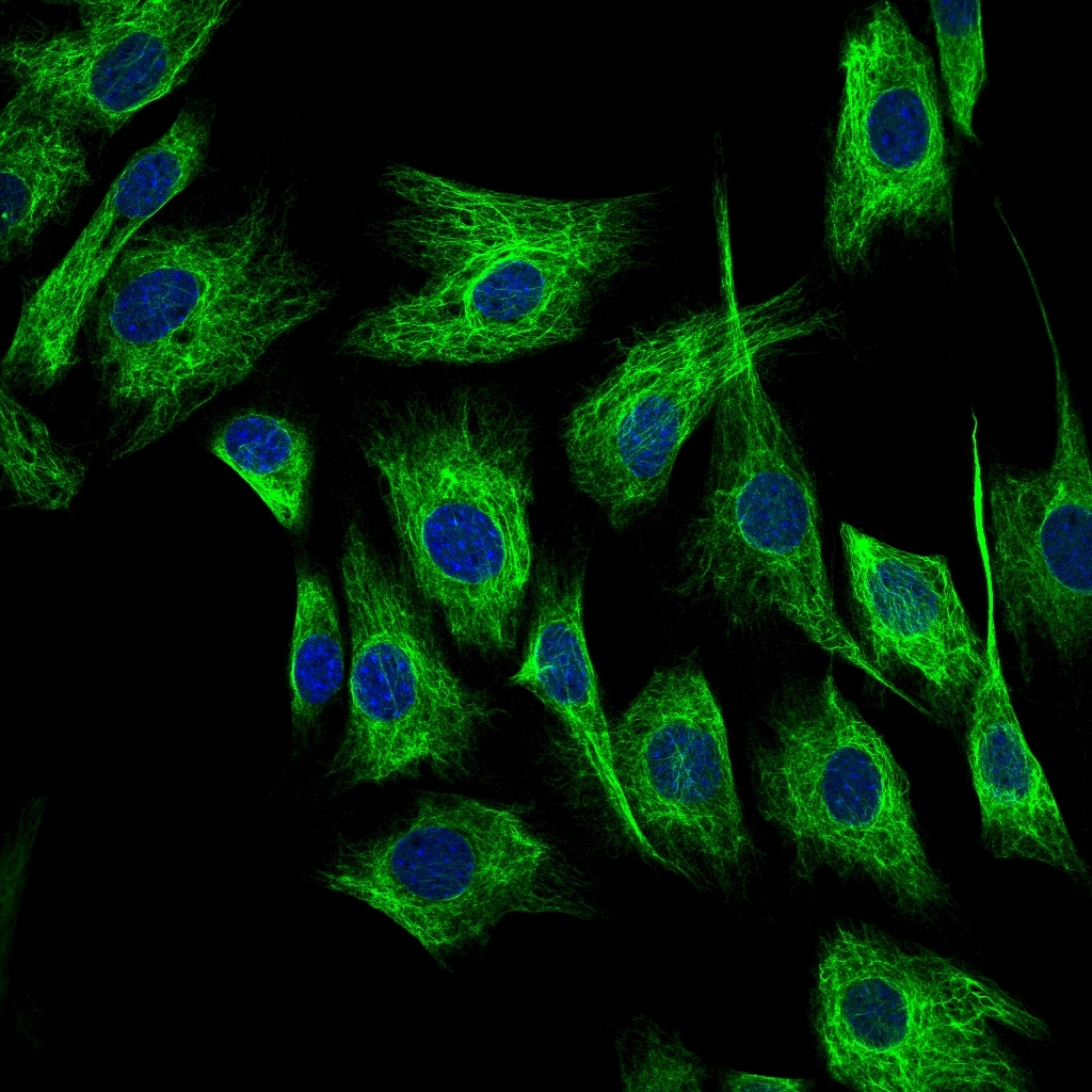 Vimentin Antibody NB300-223